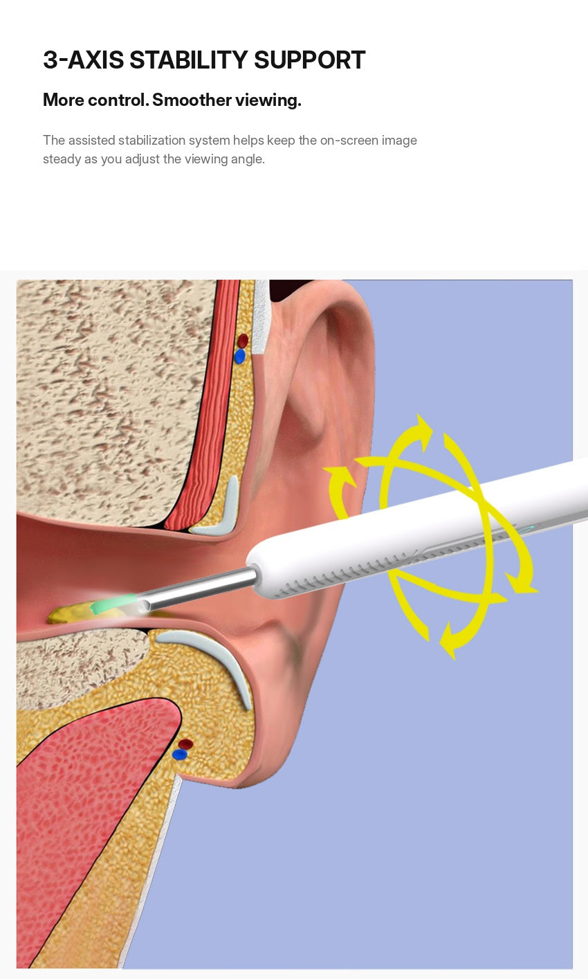8-Piece Smart Ear Cleaner Kit — Camera Viewing, LED Light & Replaceable Silicone Tips