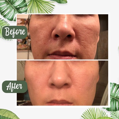 Celviron™ 100% Natural Green Tea Deep Cleanse Mask