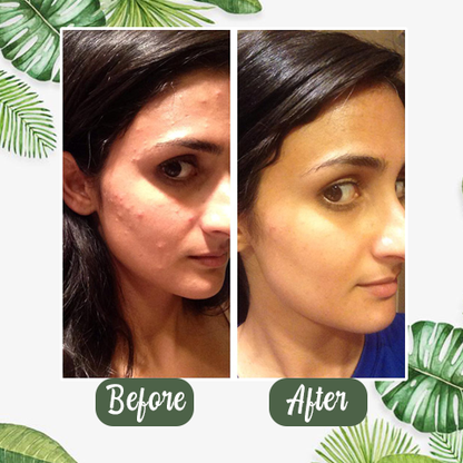 Celviron™ 100% Natural Green Tea Deep Cleanse Mask