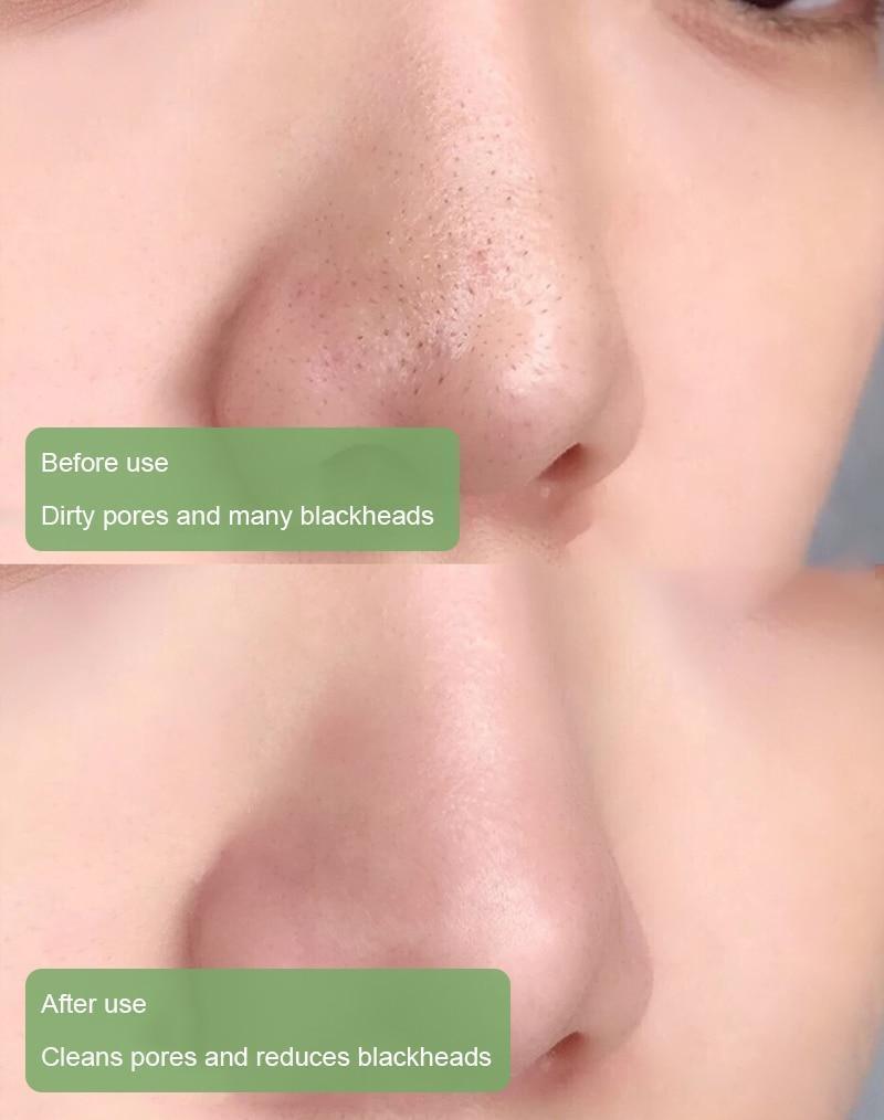 Celviron™ 100% Natural Green Tea Deep Cleanse Mask